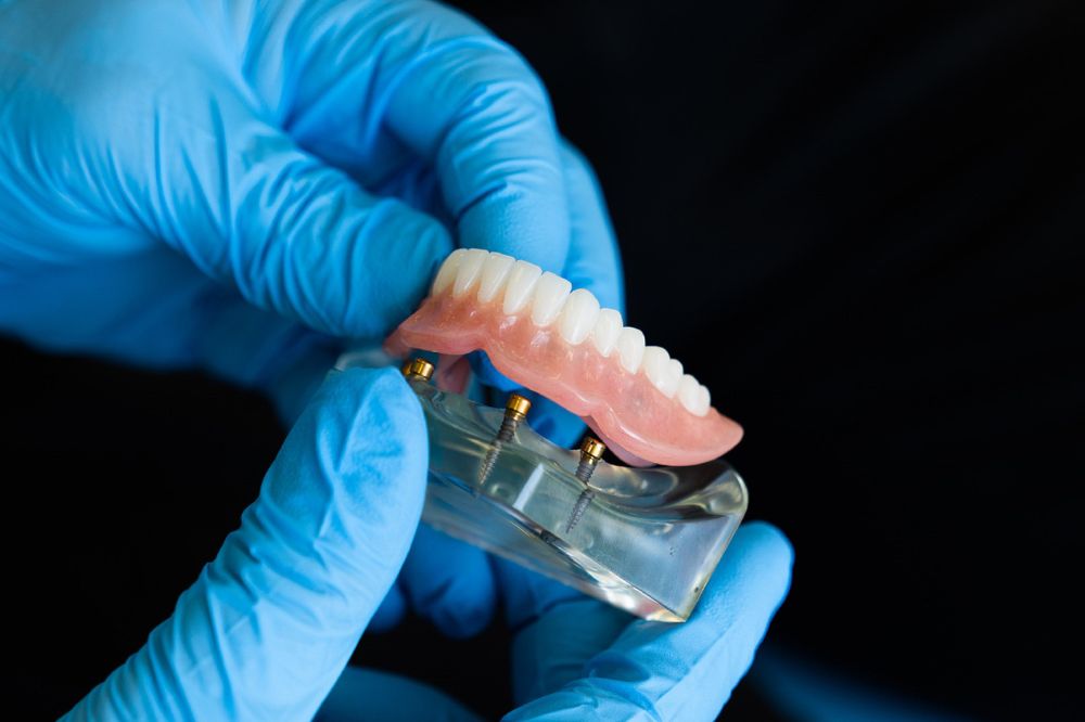 Dentures and Ageing | Dentist Acton