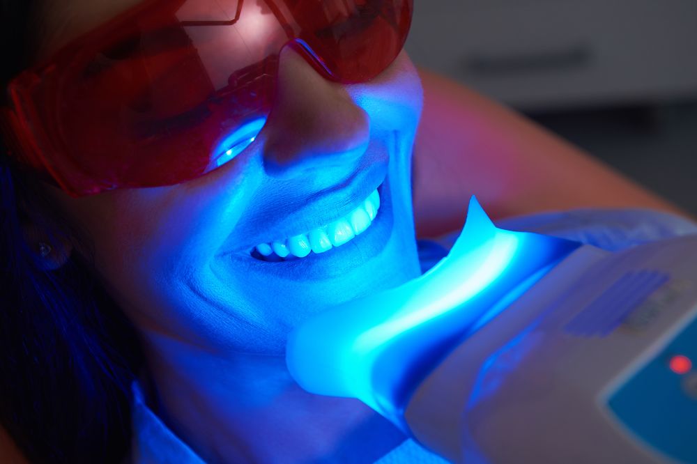 Not All Whitening Is the Same! | Dentist Acton