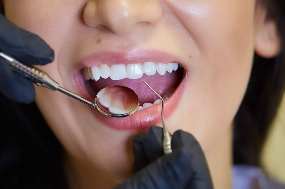 The Benefits of Regular Dental Check-Ups