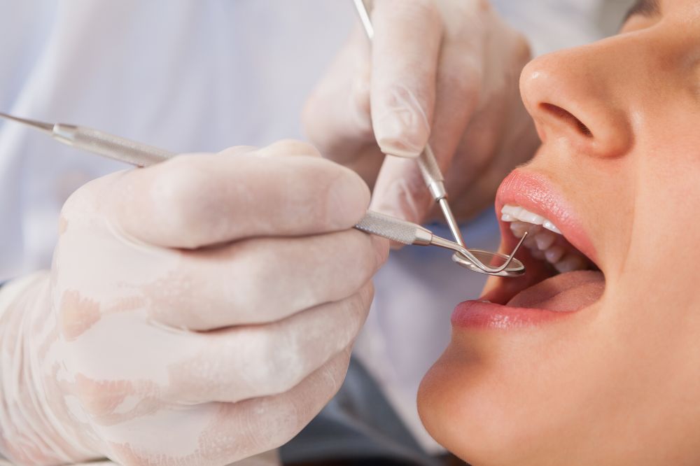 Why Dental Fillings Are Essential?